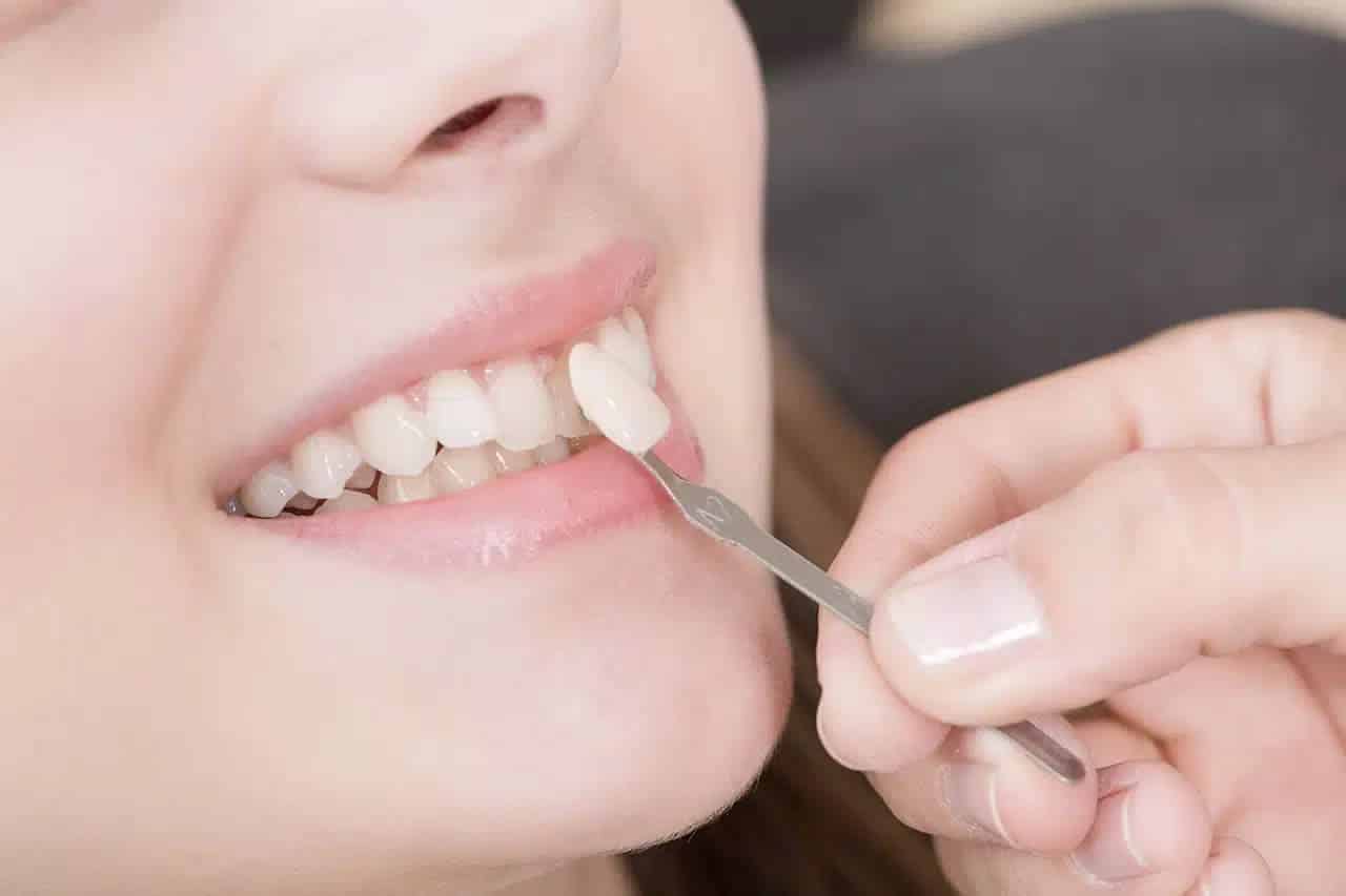 Les techniques modernes de polissage dentaire