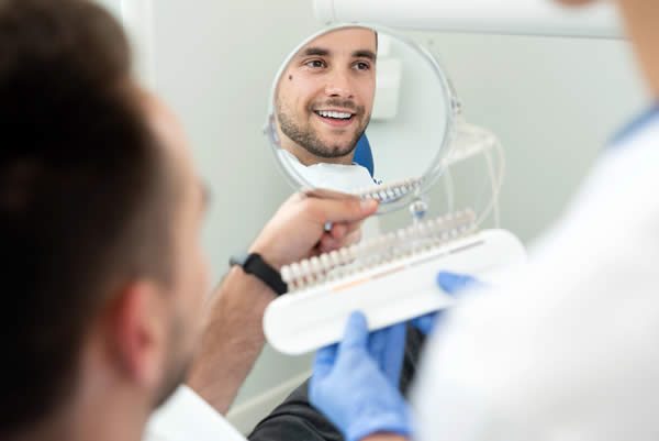 Dental veneers