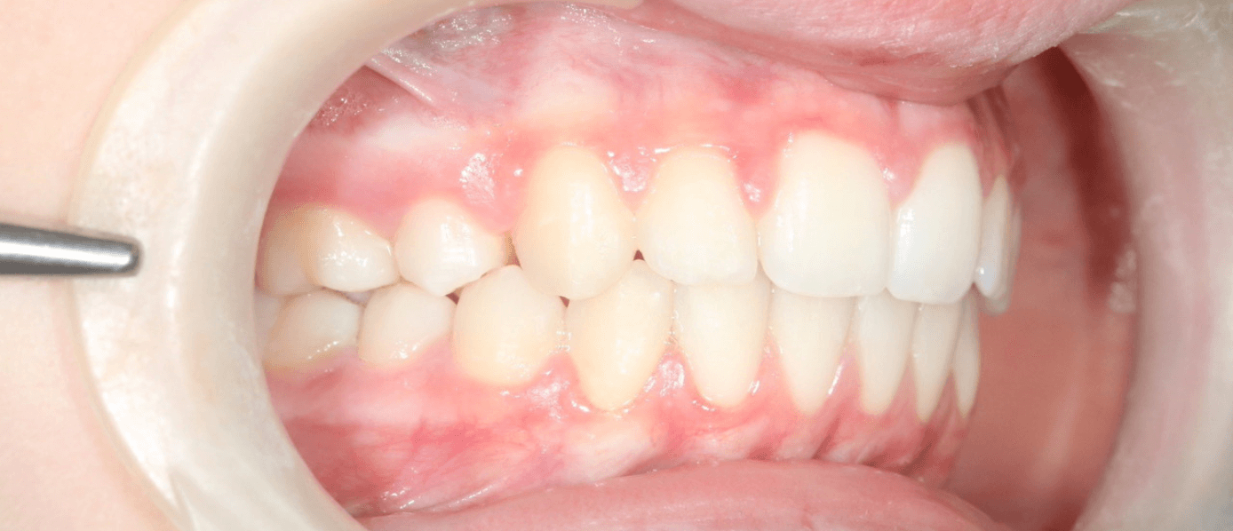 orthodontie