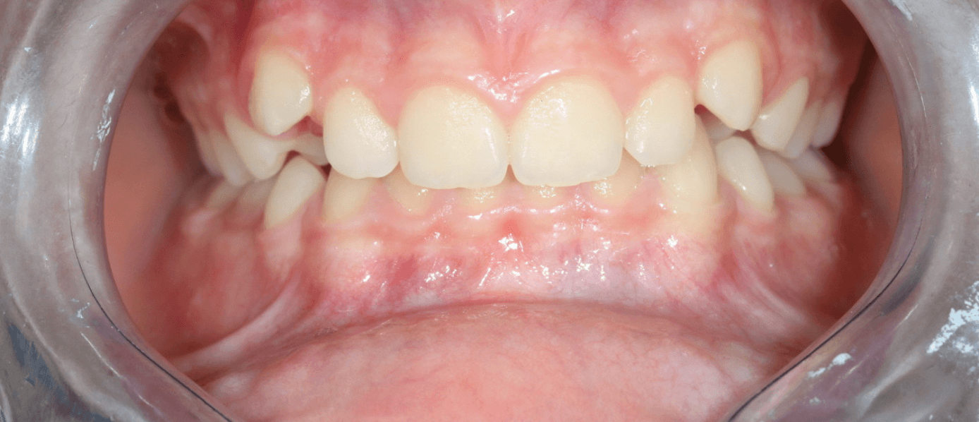 orthodontie
