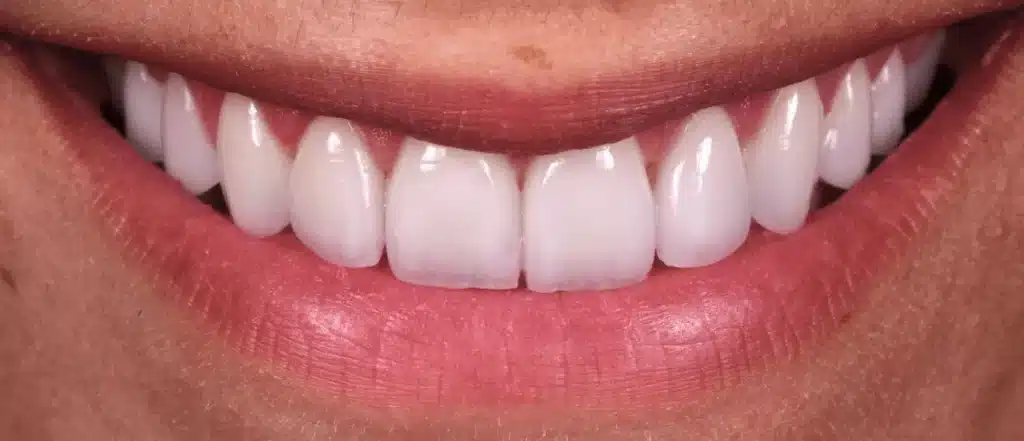 Dentist specialized in dental prostheses in Paris