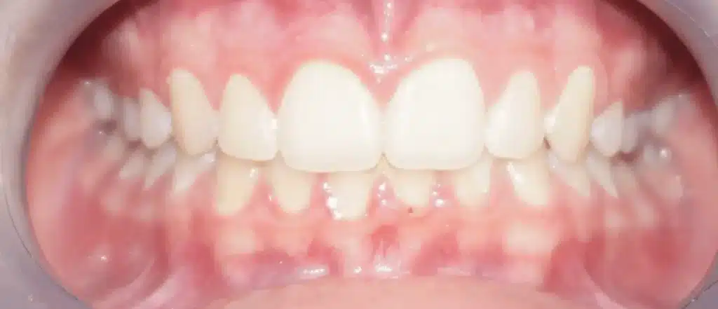 Orthodontiste Paris