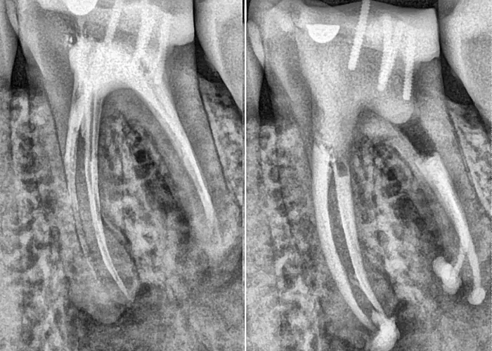 rage de dents douloureuse